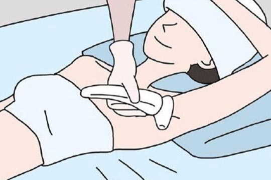 IPL光子脫毛儀