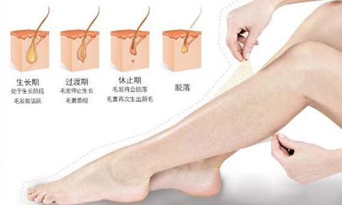 夏季脫毛：為什么有人說光子脫毛沒有效果？(圖1)
