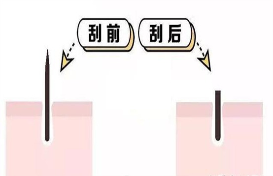 刮毛后毛發越變越硬是怎么回事(圖1)