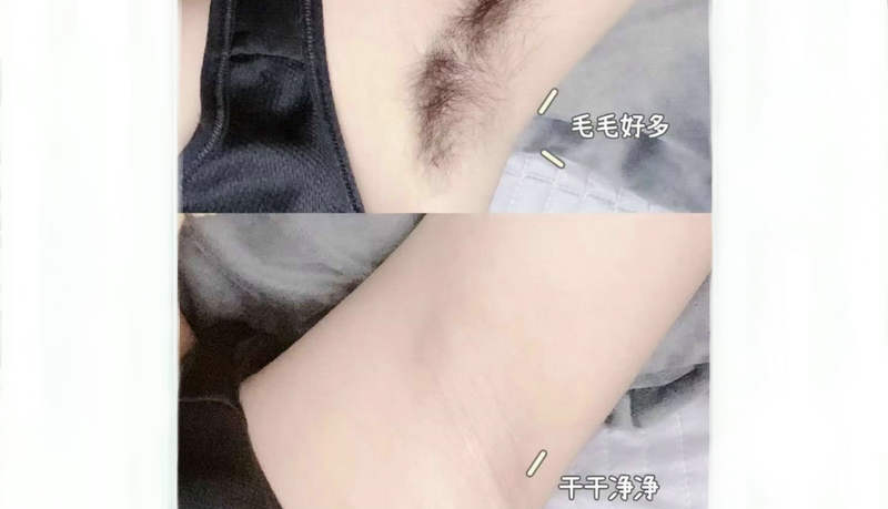 秋天脫毛有什么好處嗎？(圖1)